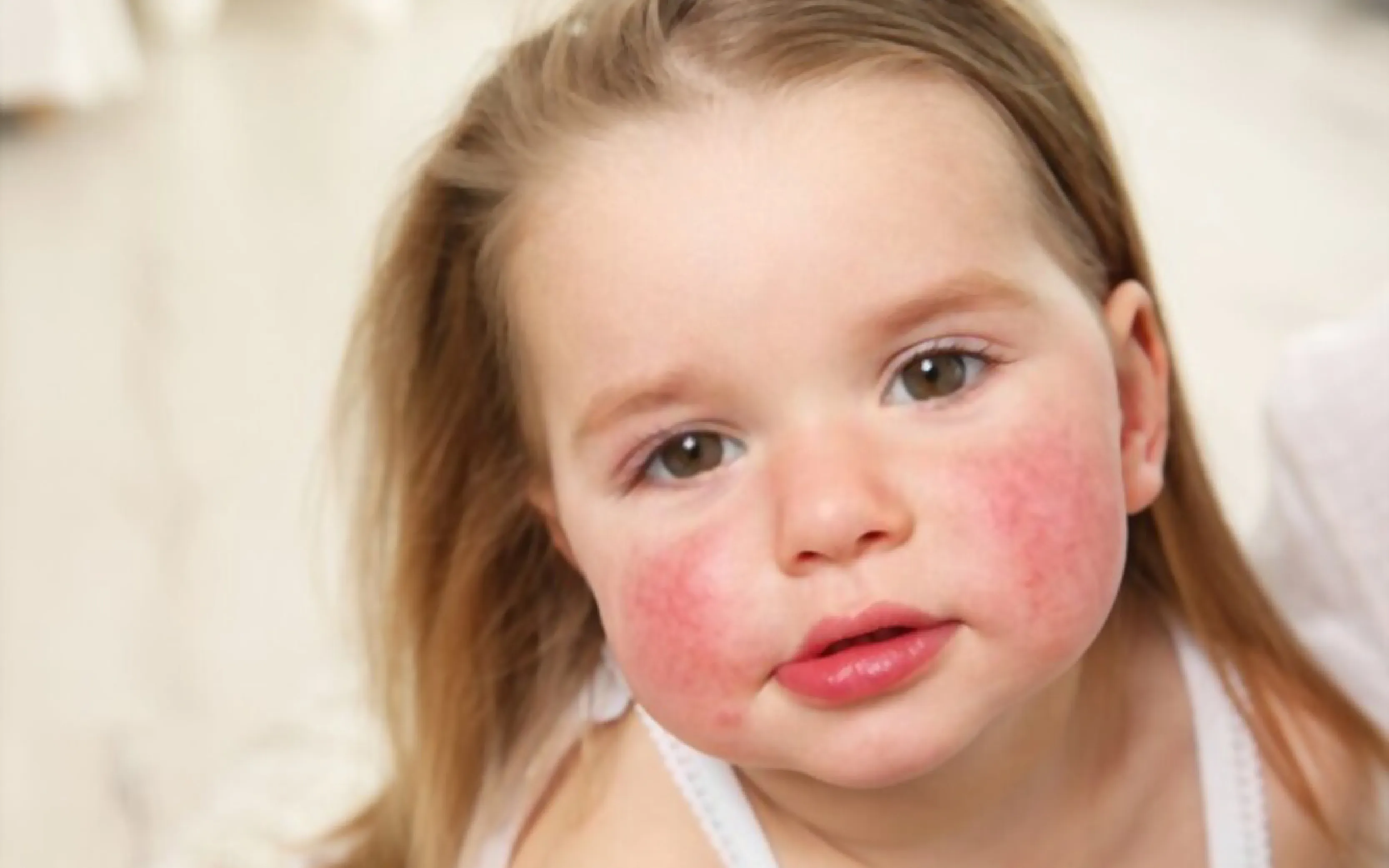 allergy cleaning service brooklyn